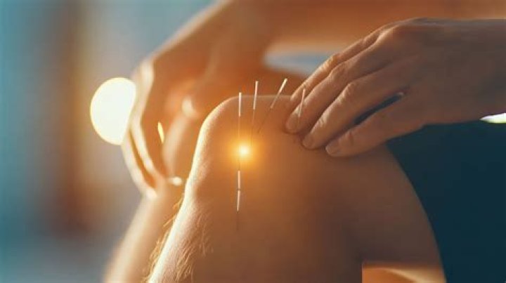 Acupuncture Improves AI-Related Joint Pain in Breast Cancer Patients