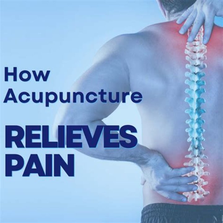 Acupuncture Relieves Joint Pain in Breast Cancer Patients Taking Hormone Therapy