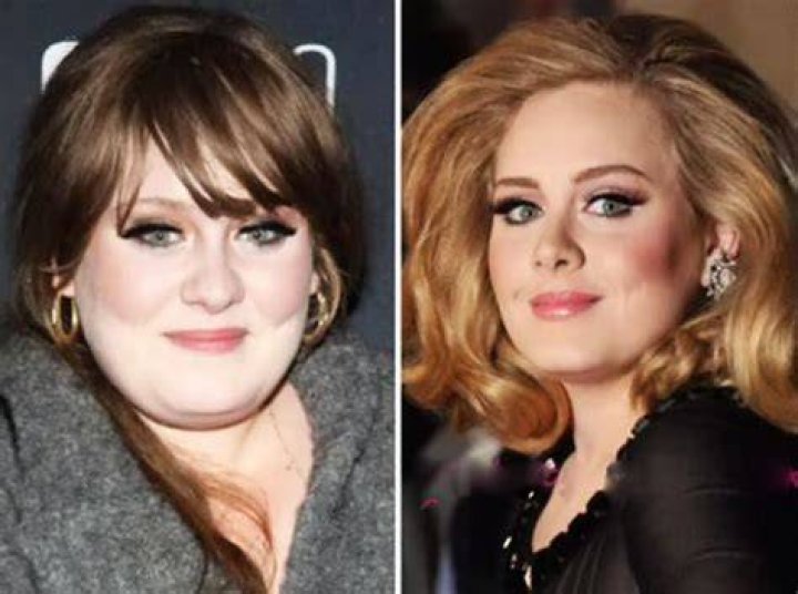 Adele Plastic Surgery: Has She Had Plastic Surgery?