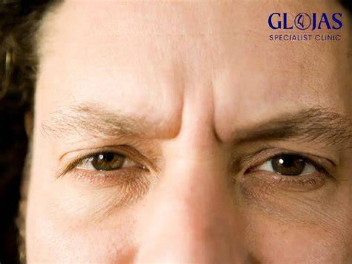 Goky is furrowing his eyebrows.