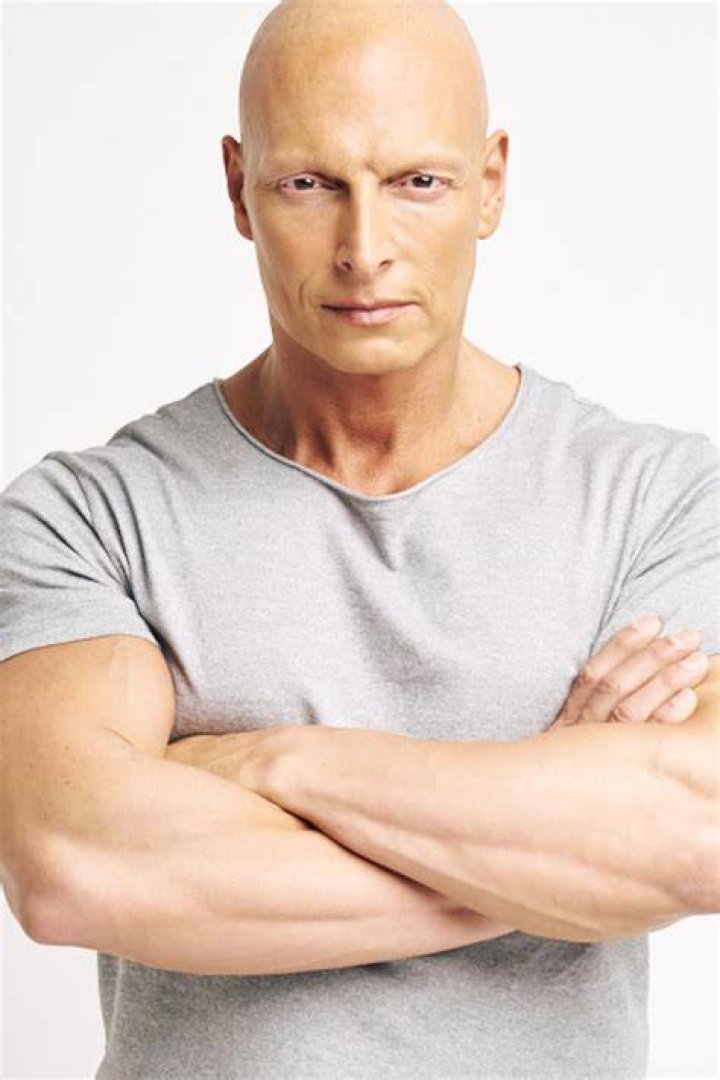 Is Joseph Gatt actually albino? 1 Joseph Gatt Source thewrap.com