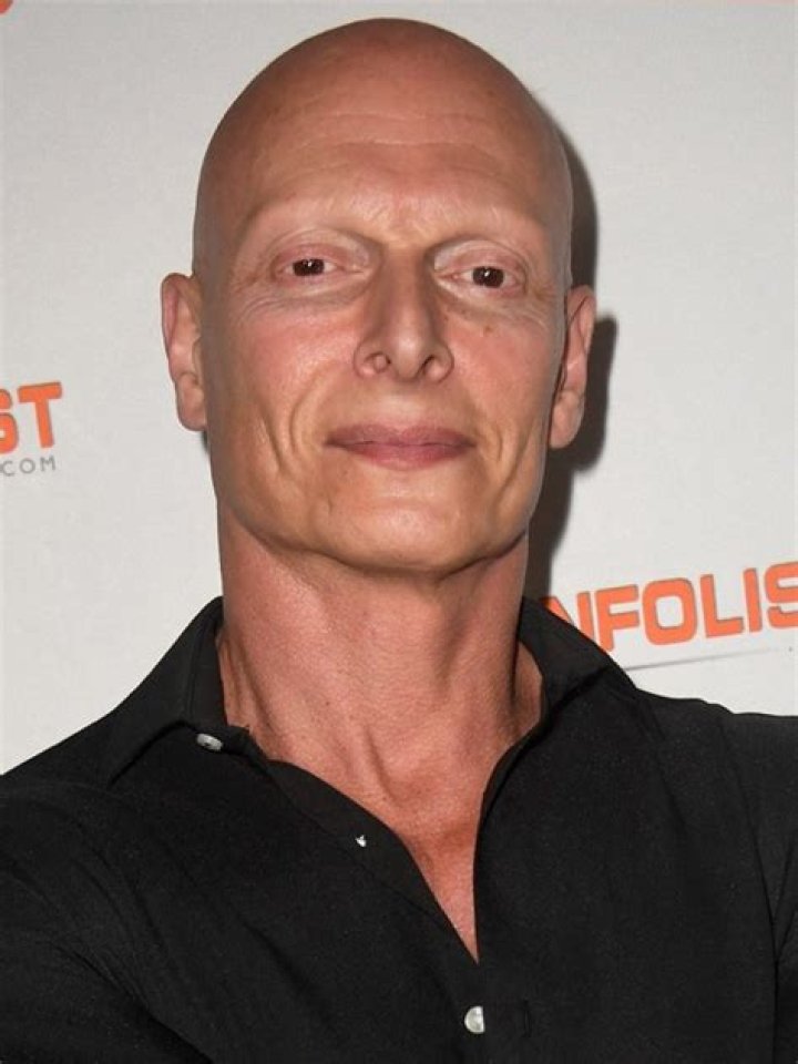 What is wrong with Joseph Gatt eyebrows? 1 Joseph Gatt