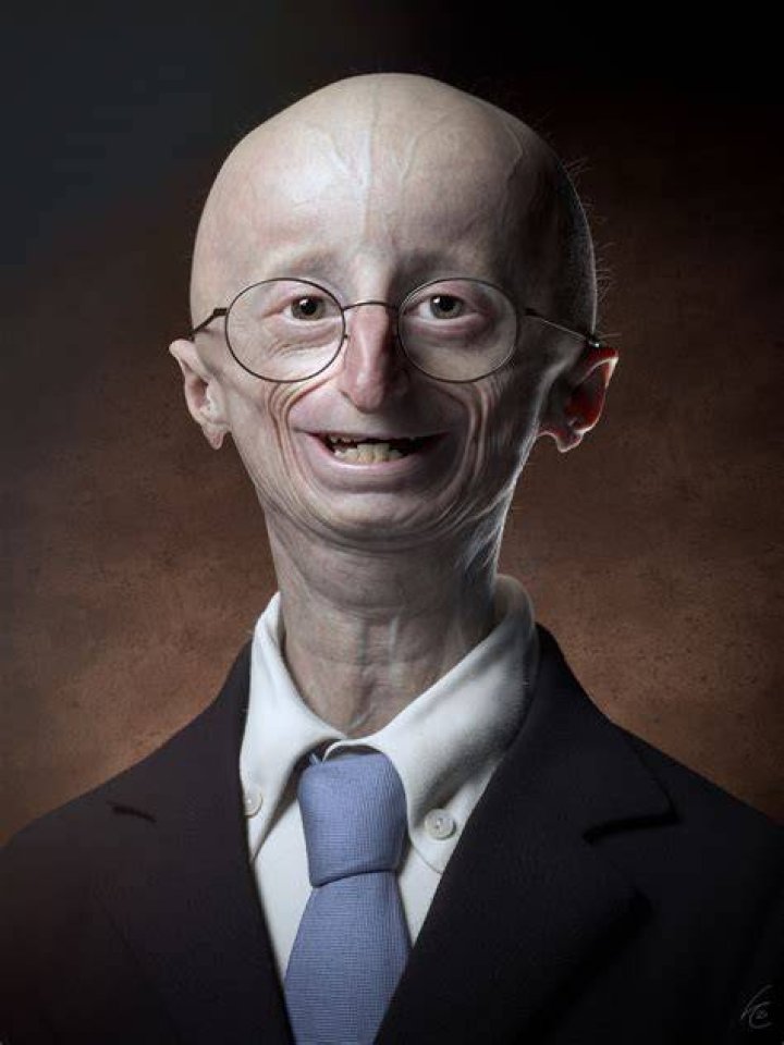 Sam Berns
